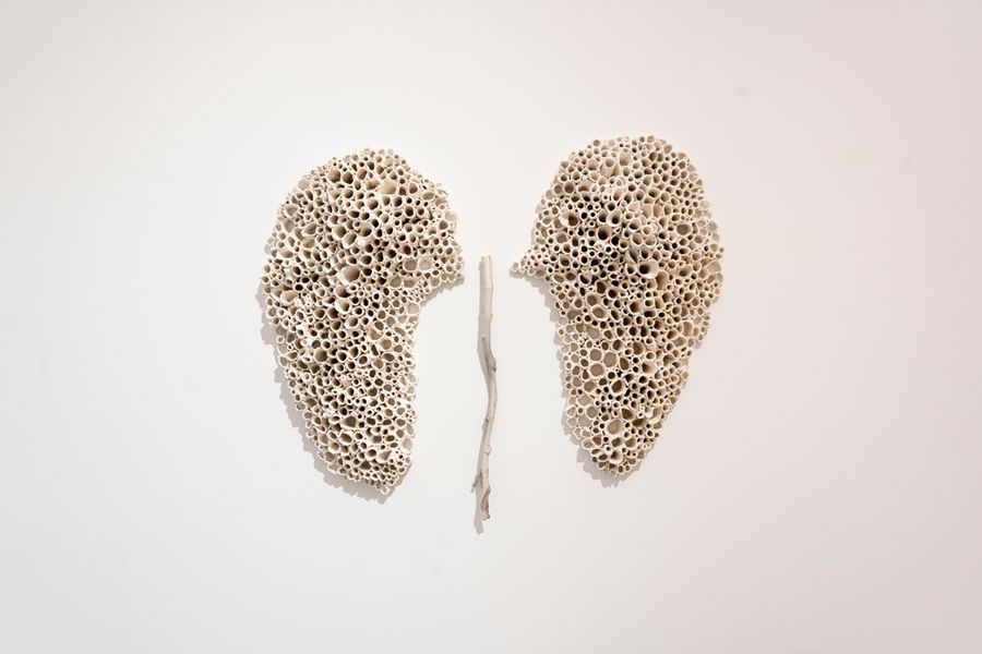 Alveoli by Ana Hillar